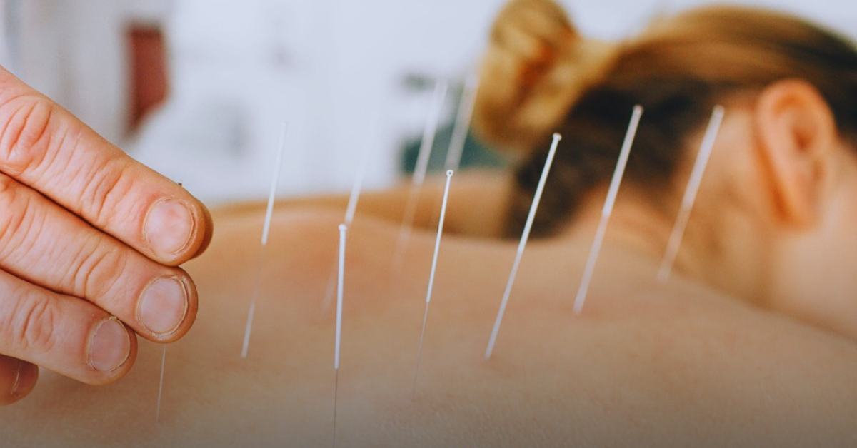 Dry needling near me